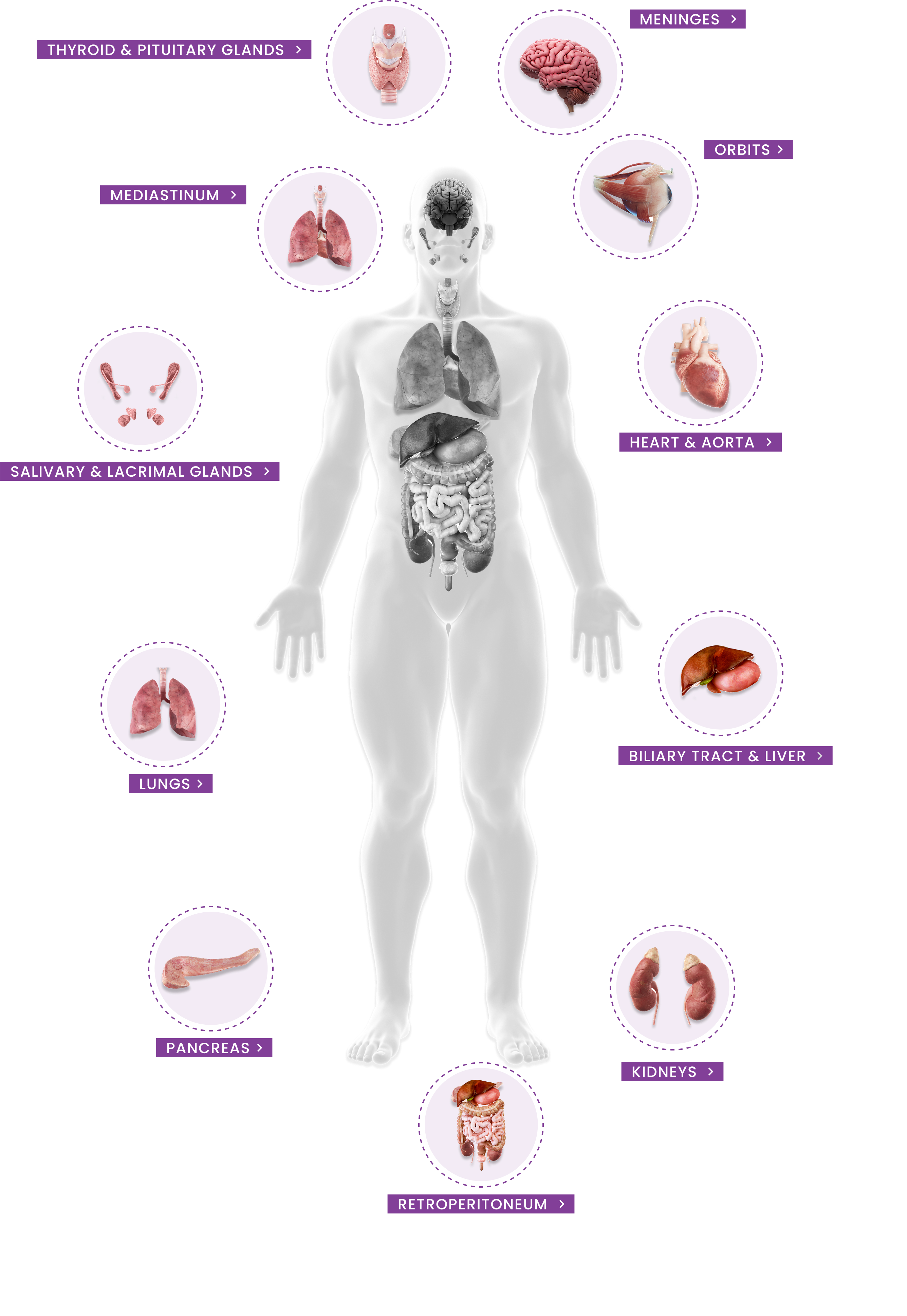 IgG4-related disease symptoms graphic