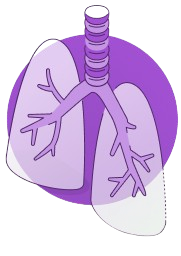 Respiratory gMG symptoms