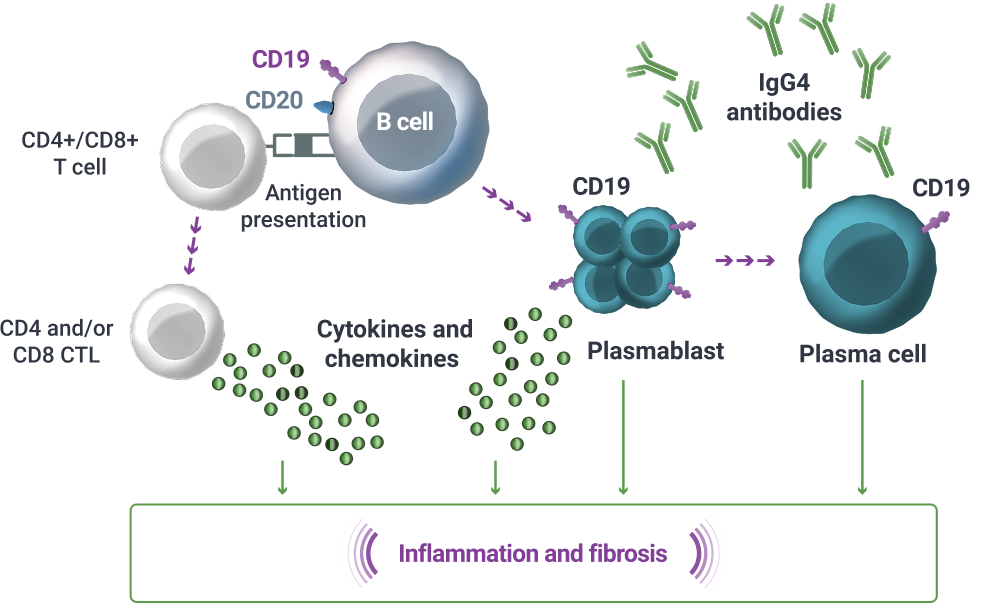 Graphic showing how CD19+ B cells are believed to be drivers of IgG4-RD immunopathogenesis